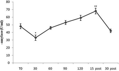 Stress Profile in Remotely Piloted Aircraft Crewmembers During 2 h Operating Mission